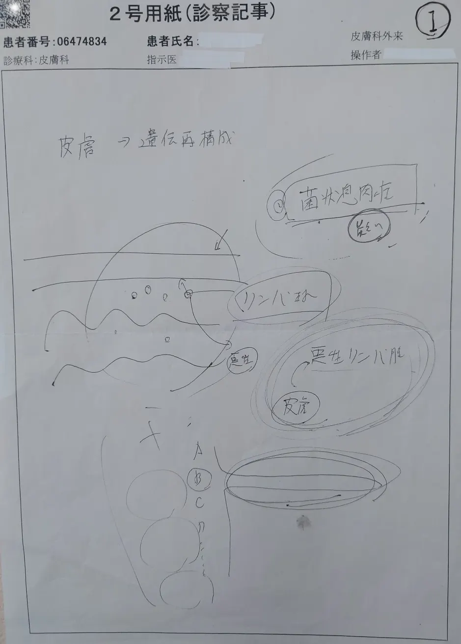 悪性リンパ腫治療前2