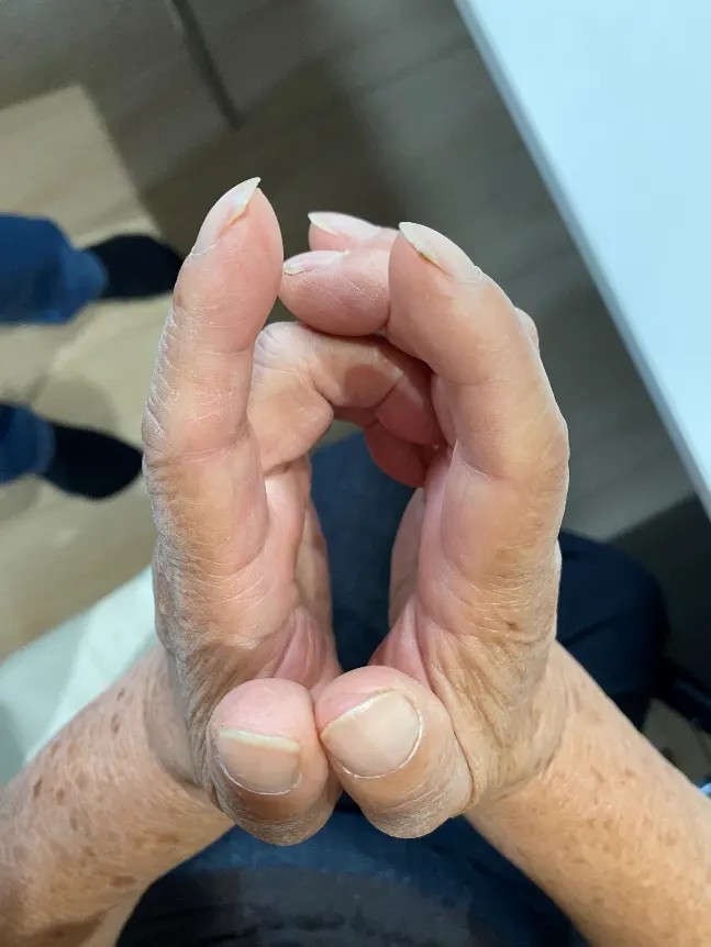 治療前
