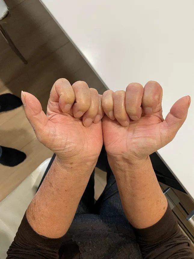 治療後