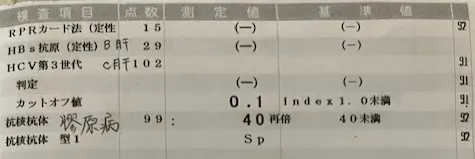 シェーグレン症候群寛解後の血液検査結果